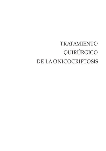 Tratamiento quirúrgico de la onicocriptosis