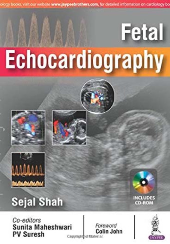 Fetal Echocardiography