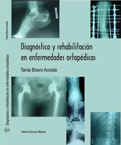 Diagnóstico y rehabilitación en enfermedades ortopédicas