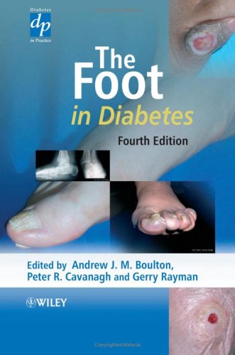 The foot in diabetes