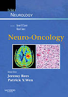 Neuro-oncology