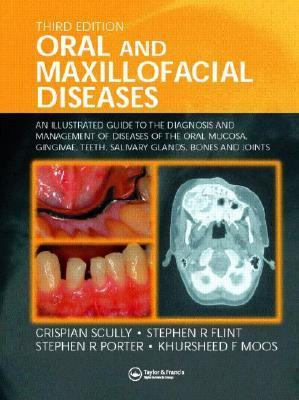 Oral and Maxillofacial Diseases