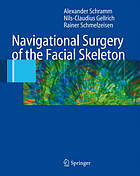 Navigational surgery of facial skeleton