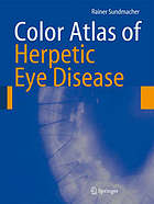 Color atlas of herpetic eye diseases : a practical guide to clinical management