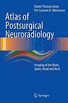 Atlas of Postsurgical Neuroradiology: Imaging of the Brain.