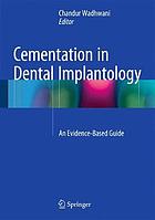 Cementation in Dental Implantology An Evidence-Based Guide