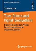 Three-Dimensional Digital Tomosynthesis : Iterative Reconstruction, Artifact Reduction and Alternative Acquisition Geometry