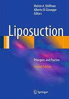 Liposuction : principles and practice