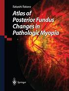 Atlas of posterior fundus changes in pathologic myopia.