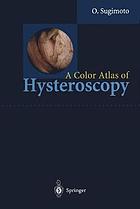 Color atlas of hysteroscopy.