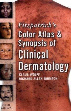 Fitzpatrick's Color Atlas and Synopsis of Clinical Dermatology