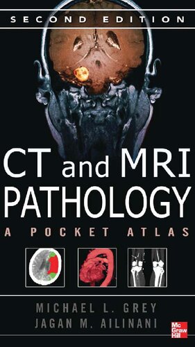 CT &amp; MRI Pathology