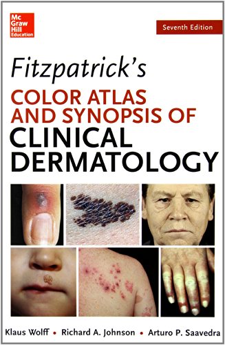 Fitzpatricks Color Atlas and Synopsis of Clinical Dermatology