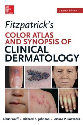 Fitzpatricks Color Atlas and Synopsis of Clinical Dermatology