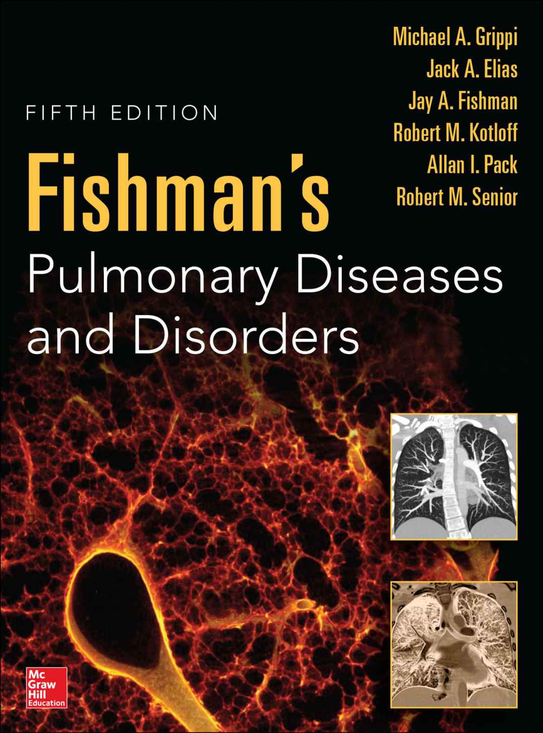 Fishman's Pulmonary Diseases and Disorders