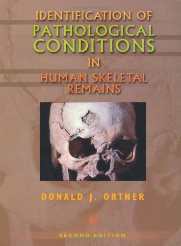 Identification of Pathological Conditions in Human Skeletal Remains