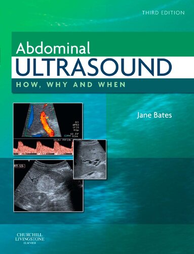 Abdominal Ultrasound