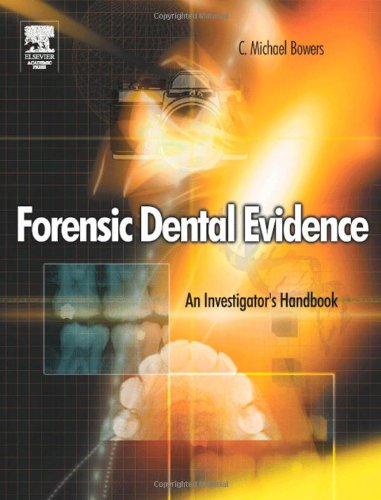 Forensic Dental Evidence: An Investigator's Handbook