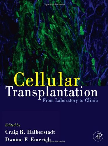 Cellular Transplantation