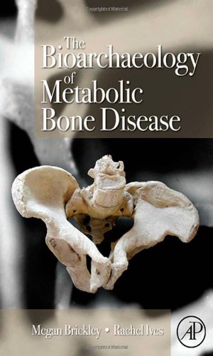 The Bioarchaeology of Metabolic Bone Disease