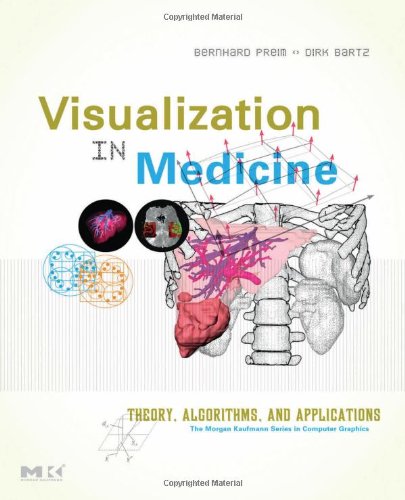 Visualization in Medicine: Theory, Algorithms, and Applications (The Morgan Kaufmann Series in Computer Graphics)