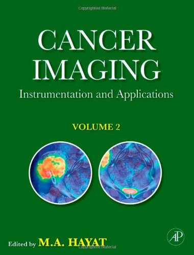 Cancer Imaging Volume 2