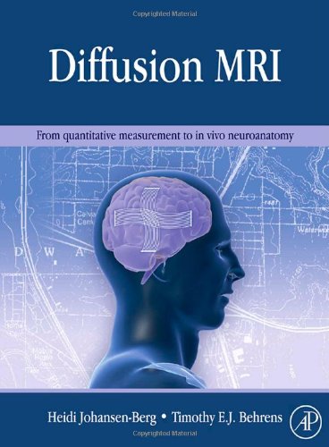 Diffusion MRI