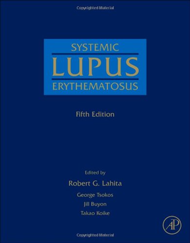 Systemic Lupus Erythematosus