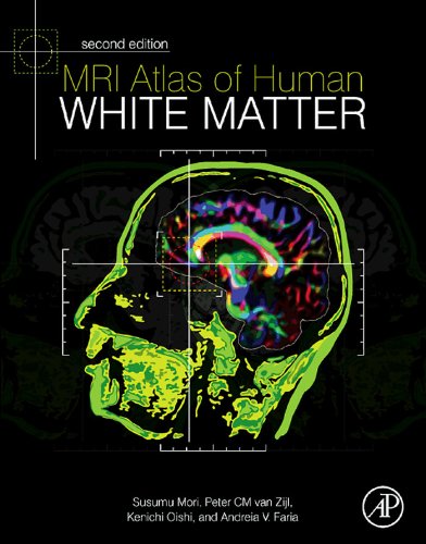 MRI Atlas of Human White Matter, Second Edition