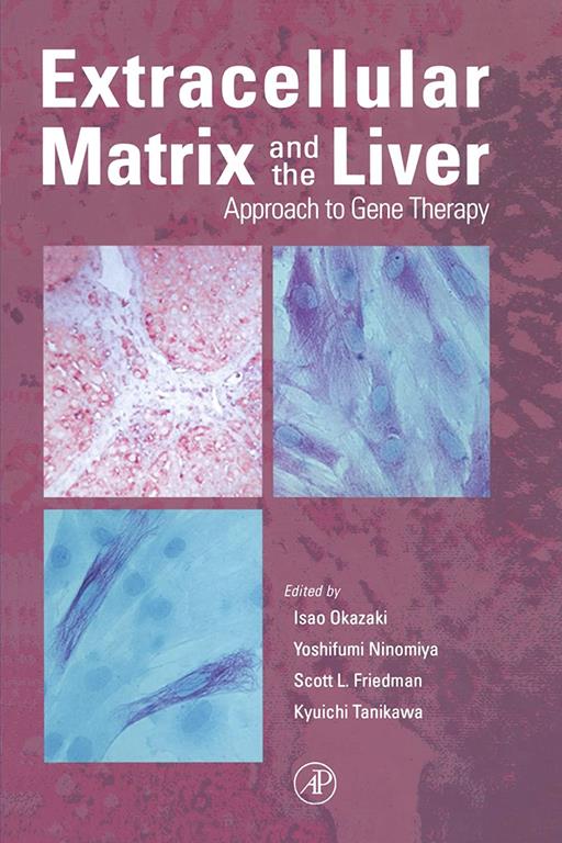 Extracellular Matrix and the Liver: Approach to Gene Therapy