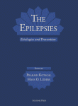 The Epilepsies