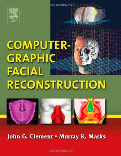 Computer-Graphic Facial Reconstruction