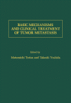 Basic Mechanisms And Clinical Treatment Of Tumor Metastasis