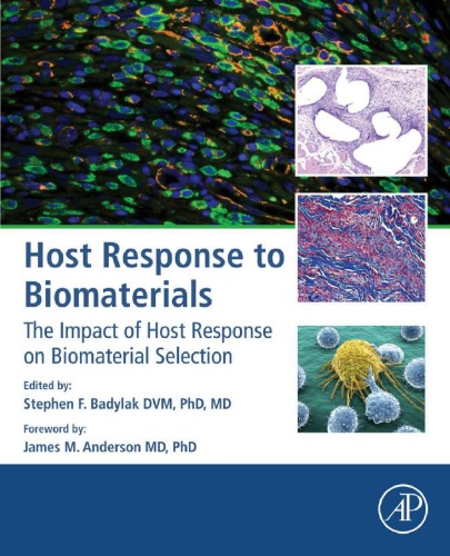 Host Response to Biomaterials : the Impact of Host Response on Biomaterial Selection.