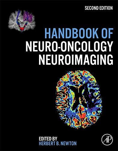 Handbook of Neuro-Oncology Neuroimaging