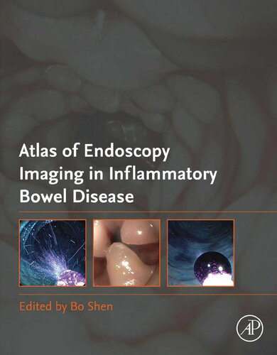 Atlas of Endoscopy Imaging in Inflammatory Bowel Disease