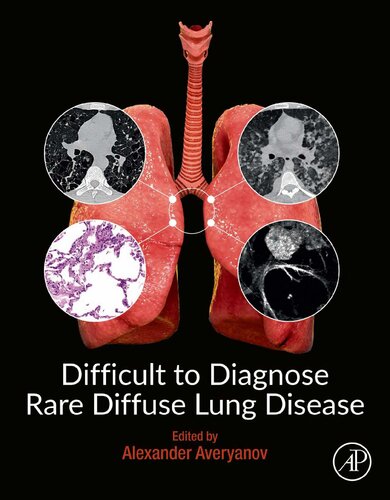 Difficult to Diagnose Rare Diffuse Lung Disease