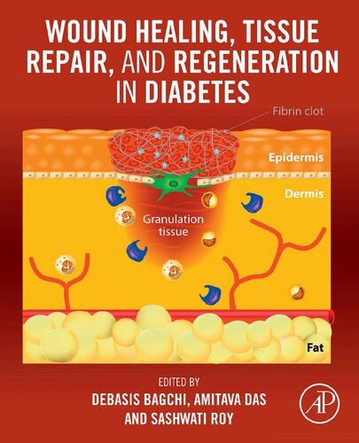 Wound Healing, Tissue Repair and Regeneration in Diabetes