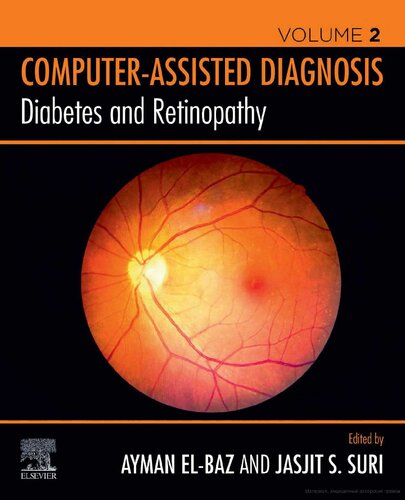 Diabetes and Retinopathy