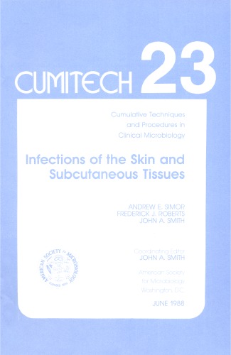 Cumitech 23