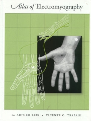 Atlas of Electromyography