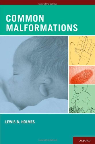 Common Malformations