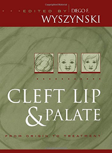 Cleft Lip and Palate