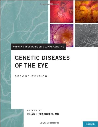 Genetic Diseases of the Eye, Second Edition (Oxford Monographs on Medical Genetics)