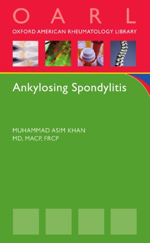 Ankylosing Spondylitis