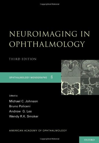 Neuroimaging in Ophthalmology (American Academy of Ophthalmology Monograph Series)