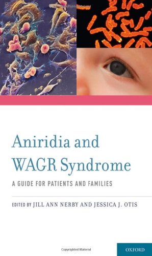 Aniridia and WAGR Syndrome
