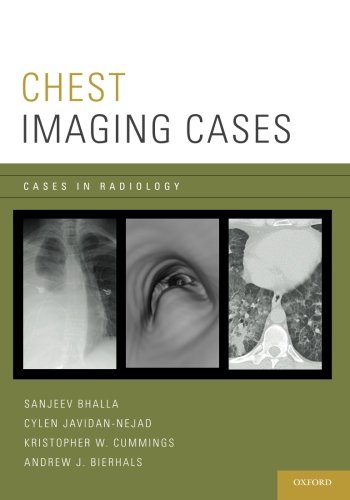 Chest Imaging Cases