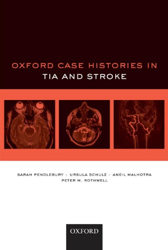 Oxford Case Histories in Stroke