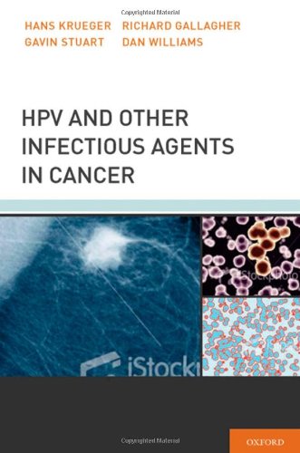 HPV and Other Infectious Agents in Cancer